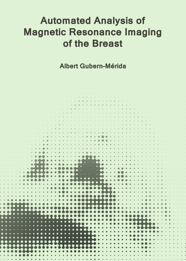 Automated Analysis of Magnetic Resonance Imaging of the Breast
