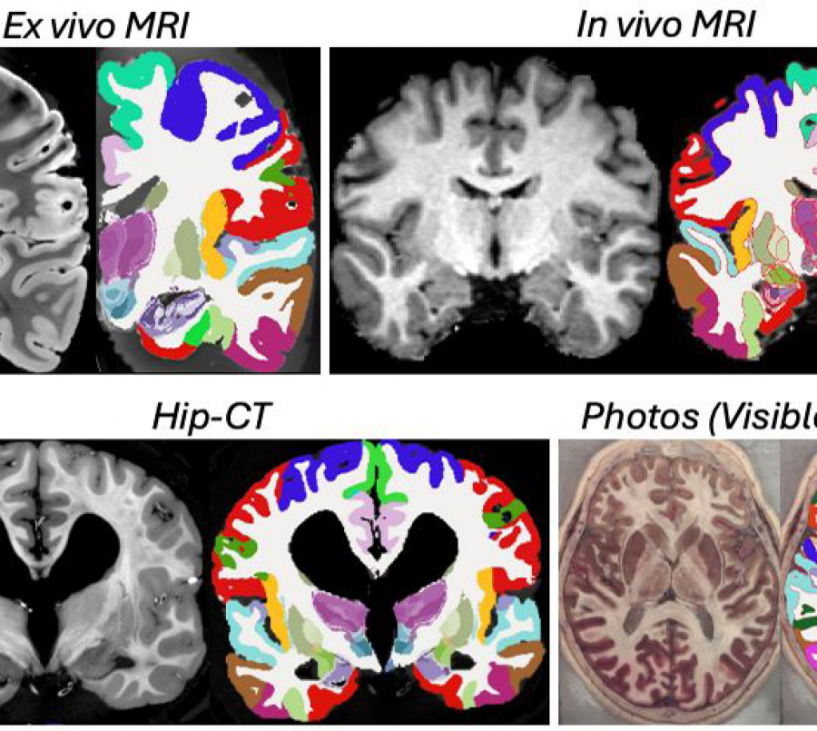 MRI scans